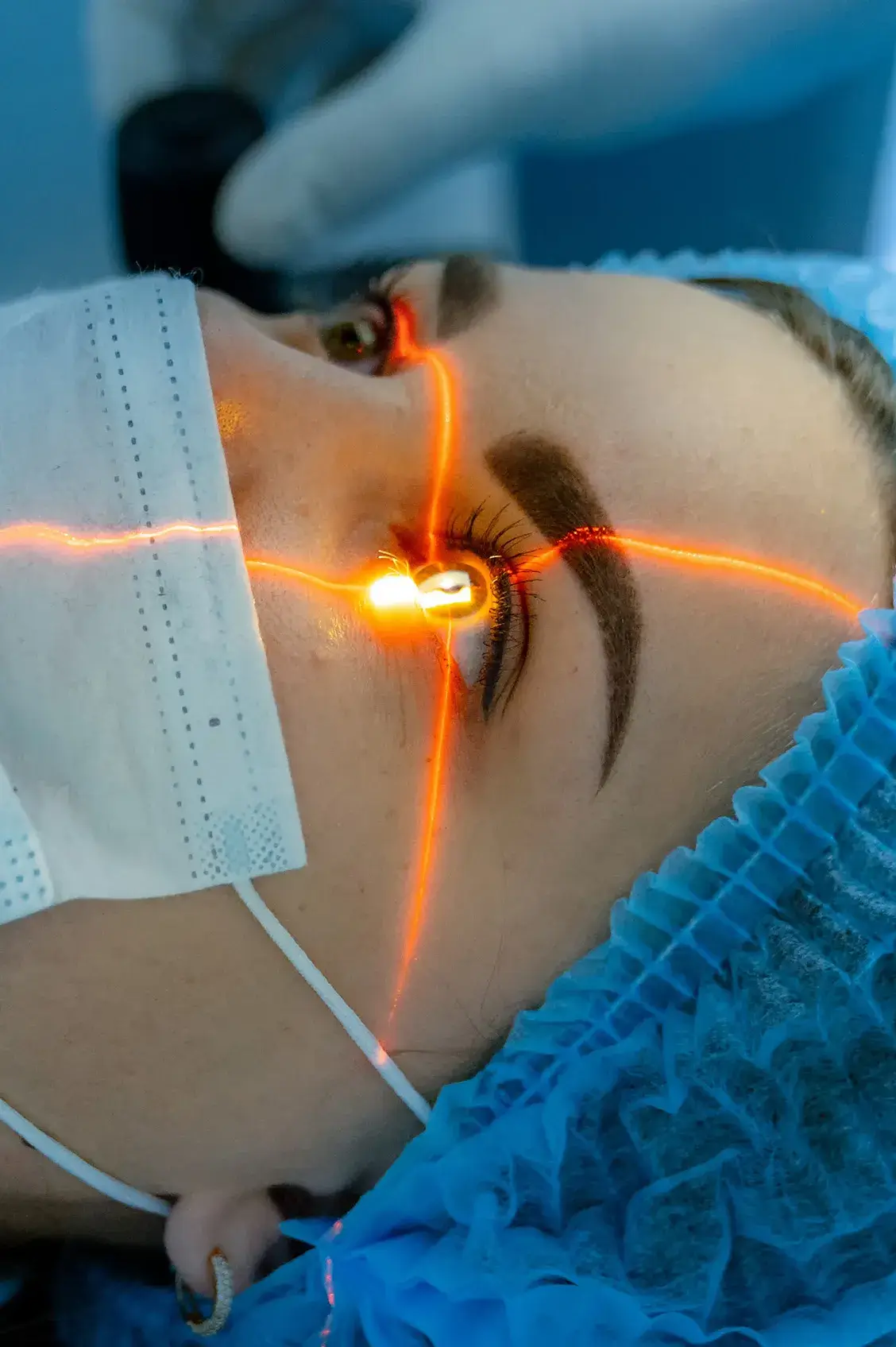 Woman undergoing laser cataract surgery