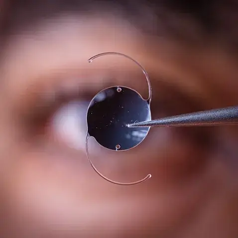 IOL held in front of eye